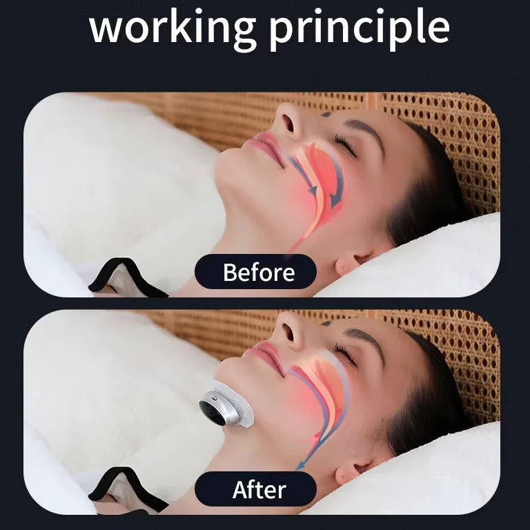 The AI-Slumber Guard: Snoring Support Device with Real-Time Stimulation Adjustment