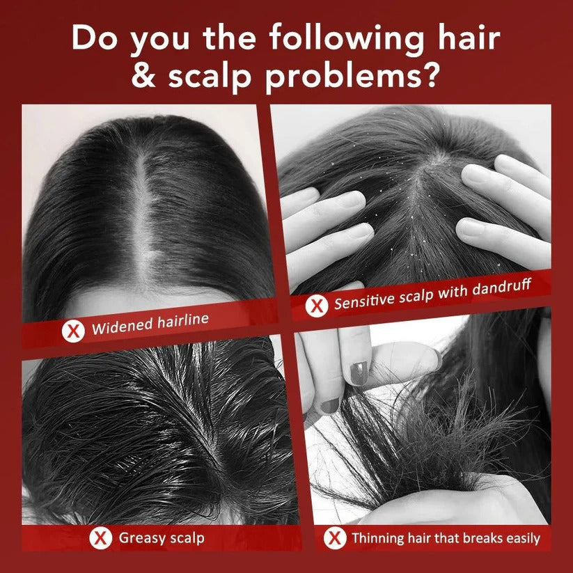 The Root-Revive Pro: 650nm Red Light Scalp Massager for Hair Density